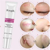 Skin Repair Cream