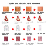 Nursing Vein, Care Cream