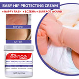 Baby Hip Moisturizing, Skin Repair, Nappy Rash Cream