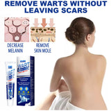 Zhongcao Keyou Liquid, Ordinary Yukeyou Skin care Lotion, Wart Removing Cream