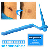 Skin Tag Removal Kit